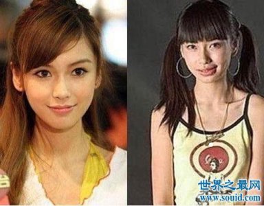 ​杨颖整容前后，杨颖整容呀 对比
