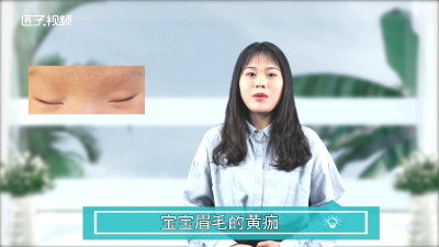 ​婴儿眉毛黄痂需要清洗吗