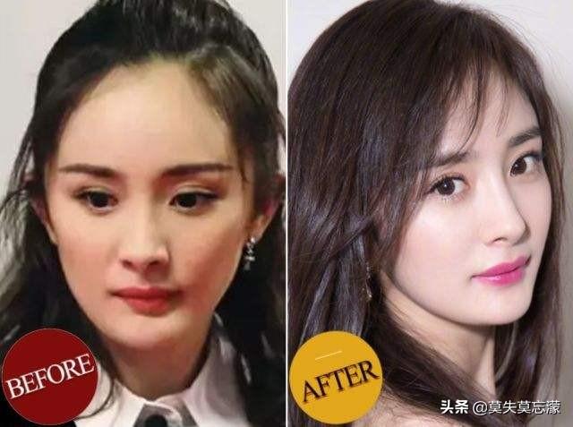 为什么人家的发际线都那么好看(发际线对一个人的颜值有多重要)(4)