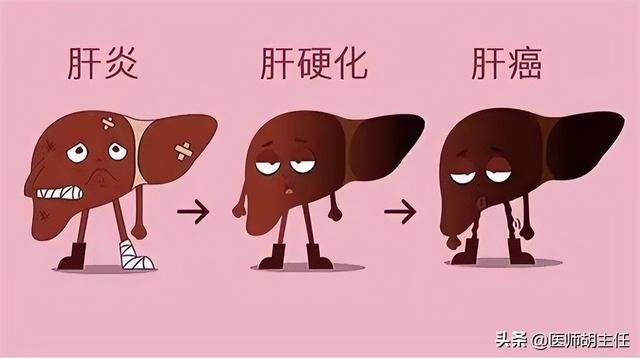 肝癌出现悄无声息3个症状经常出现（肝癌并非毫无征兆）(3)