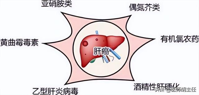 肝癌出现悄无声息3个症状经常出现（肝癌并非毫无征兆）(6)