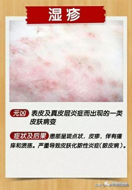 狗狗身上的皮肤病怎么治疗能好?狗狗皮肤病治疗方法(5)