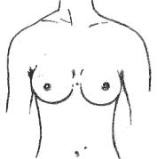 面部痣所对应身体各部位的痣(男女全身痣相图文详解)(27)