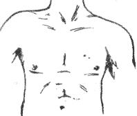 面部痣所对应身体各部位的痣(男女全身痣相图文详解)(26)