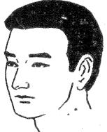 面部痣所对应身体各部位的痣(男女全身痣相图文详解)(24)