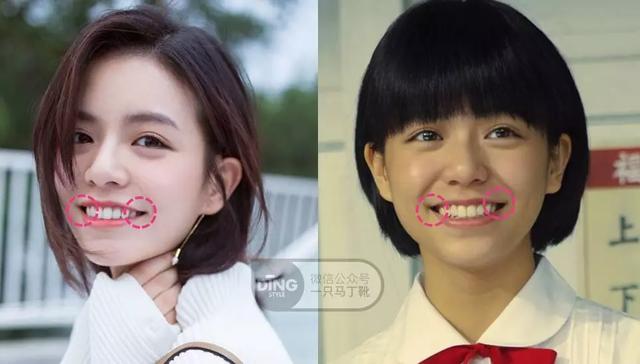 凸嘴整形方法(做好表情管理比化妆修饰效果更好)(45)