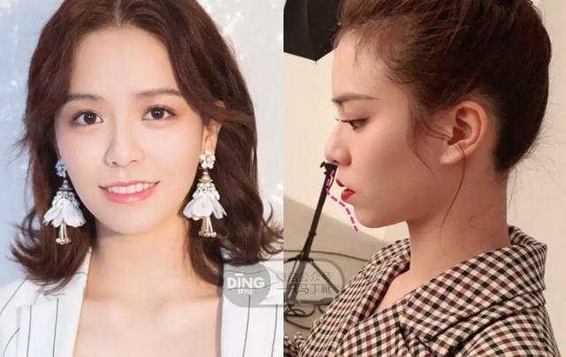 凸嘴整形方法(做好表情管理比化妆修饰效果更好)(40)