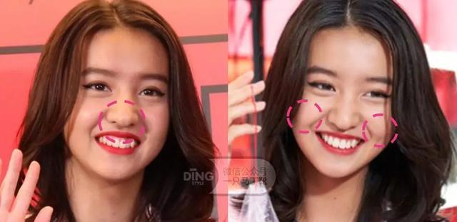 凸嘴整形方法(做好表情管理比化妆修饰效果更好)(32)