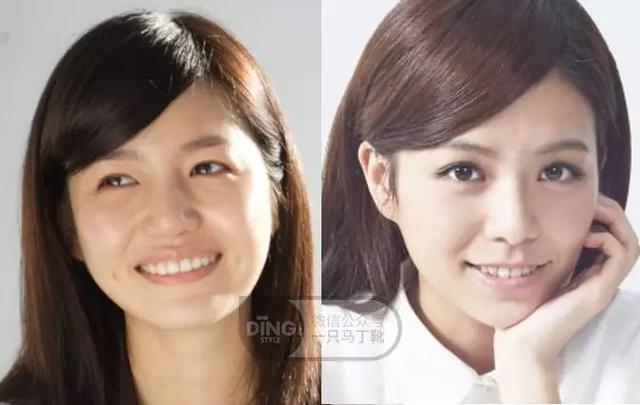 凸嘴整形方法(做好表情管理比化妆修饰效果更好)(41)