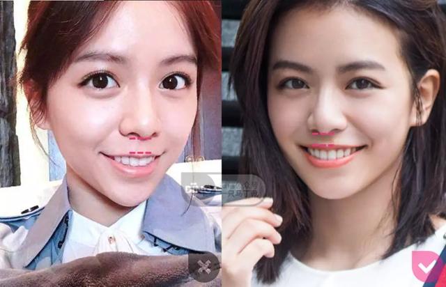 凸嘴整形方法(做好表情管理比化妆修饰效果更好)(46)