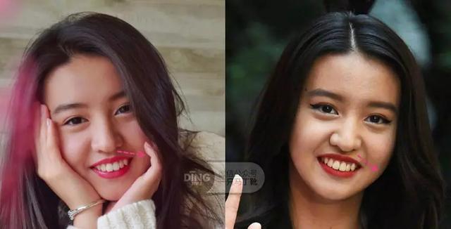 凸嘴整形方法(做好表情管理比化妆修饰效果更好)(30)