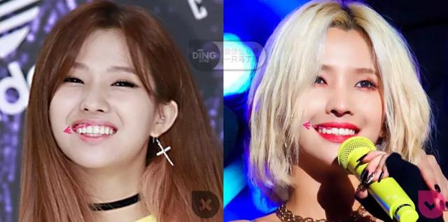 凸嘴整形方法(做好表情管理比化妆修饰效果更好)(17)