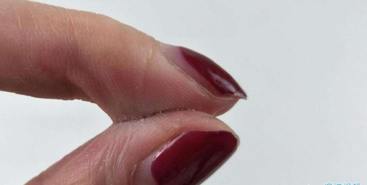 502粘住手了怎么办?