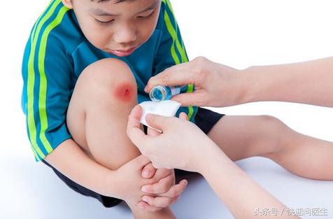 怎样消肿化瘀最有效（日常小知识如何消肿散瘀）(3)