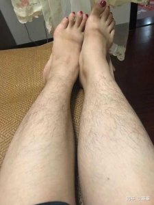 ​腿毛太多怎么办