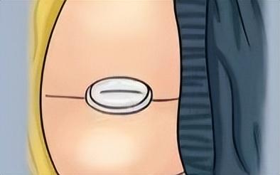 便秘使用开塞露的正确方法(便秘好帮手会依赖)(2)