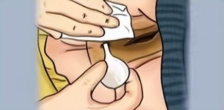 便秘使用开塞露的正确方法(便秘好帮手会依赖)(3)