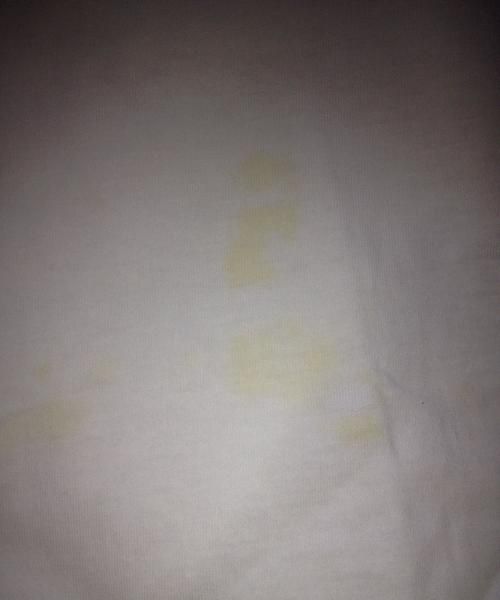 衣服用漂白剂没有用水稀释变黄了咋办?