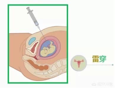 罗湖妇科医院-第7张图片-