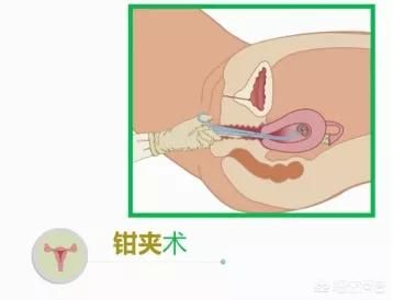 罗湖妇科医院-第5张图片-