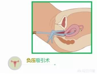 罗湖妇科医院-第4张图片-