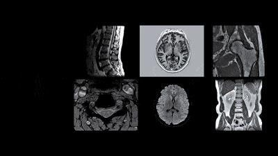 dr是什么检查有什么要求(dr是什么检查项目)