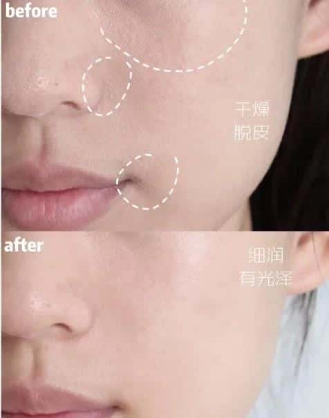 ahc神仙水乳套装怎么样（ahc面膜怎么样）