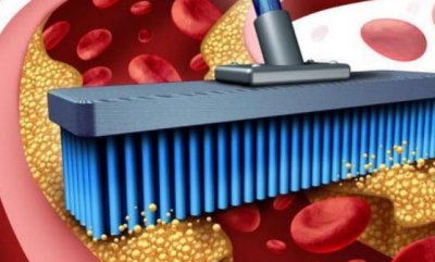 ​蔬菜清理血管垃圾 食疗调理效果最佳