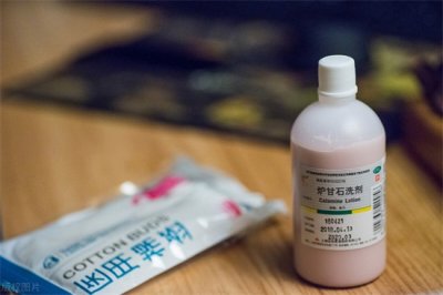 ​炉甘石洗剂的副作用 用途竟然这么广！但3种情况不能用