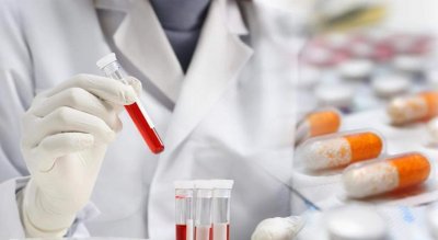 ​血常规能检查出什么 血常规检查可以看出什么