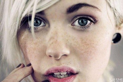 ​长斑是缺什么维生素 如何消除色斑