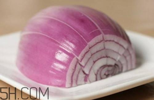 头发油怎么办?头皮屑很多怎么去除? 头发油怎么办?头皮屑很多怎么去除?