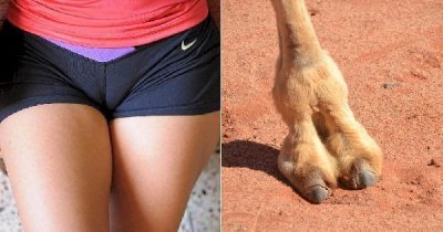 ​骆驼趾是什么意思