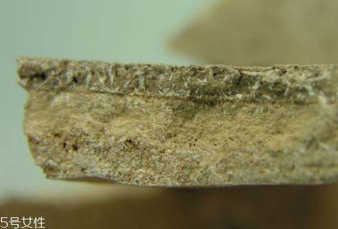 人中黄和人中白分别是什么 人中黄和人中白的区别 人中黄和人中白分别是什么 人中黄和人中白的区别