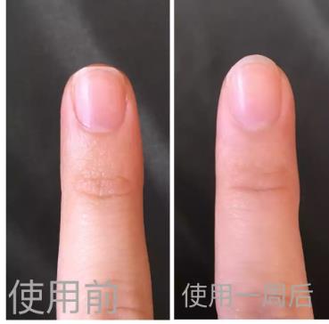 伯特小蜜蜂美甲修护霜怎么用 小蜜蜂护甲霜用法 伯特小蜜蜂美甲修护霜怎么用 小蜜蜂护甲霜用法