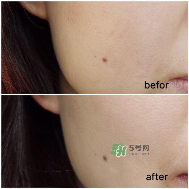 城野医生377成分 城野医生377美白精华白天能用吗 城野医生377成分 城野医生377美白精华白天能用吗