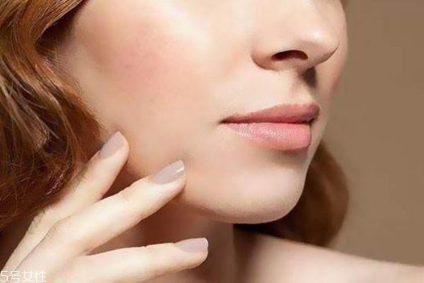 红血丝是什么 红血丝怎么护理 红血丝是什么 红血丝怎么护理