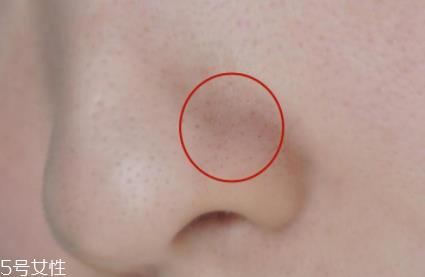 薇姿魔幻水怎么样?薇姿水光焕亮角质调理液好用吗? 薇姿魔幻水怎么样?薇姿水光焕亮角质调理液好用吗?