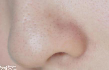 薇姿魔幻水怎么样?薇姿水光焕亮角质调理液好用吗? 薇姿魔幻水怎么样?薇姿水光焕亮角质调理液好用吗?