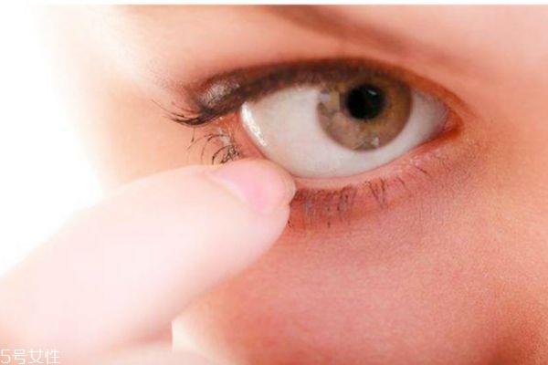 戴美瞳会得眼结石吗 教你健康佩戴 戴美瞳会得眼结石吗 教你健康佩戴