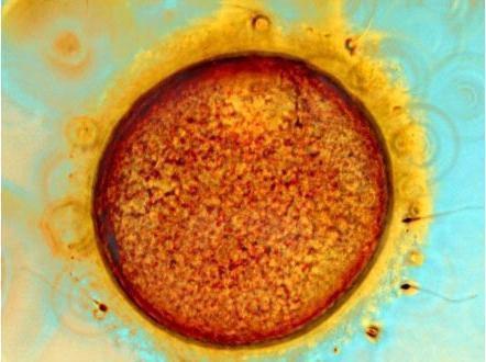 做人工授精全过程(附图), 看着都痛, 真的心疼女人一万遍