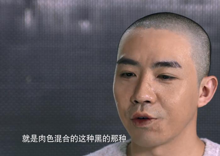 俞灏明再谈烧伤,首度承认失恋,还称为Selina做了一件很男人的事