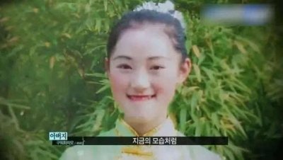 ​女孩长相太丑被人嘲讽，远赴韩国整容后，变成漂亮美少女