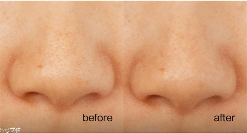 悦诗风吟慕斯清洁面膜温和吗?干皮慎用 悦诗风吟慕斯清洁面膜温和吗?干皮慎用