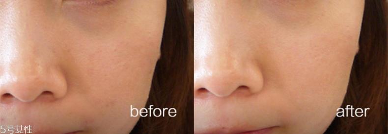 悦诗风吟慕斯清洁面膜温和吗?干皮慎用 悦诗风吟慕斯清洁面膜温和吗?干皮慎用