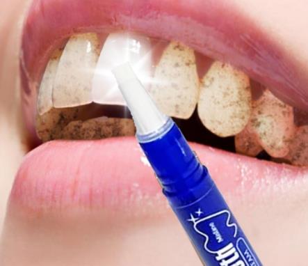 美牙笔怎么用?美牙笔使用步骤 美牙笔怎么用?美牙笔使用步骤