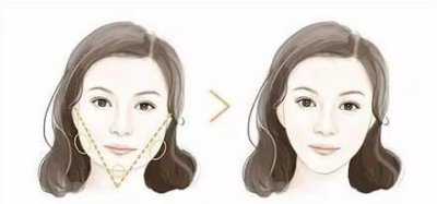 ​频繁打“瘦脸针”的女人，老了之后有什么变化？美容专家一语道破