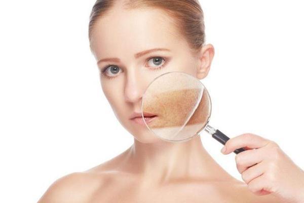 毛孔粗大可以刷酸吗 毛孔粗大可以看皮肤科吗 毛孔粗大可以刷酸吗 毛孔粗大可以看皮肤科吗