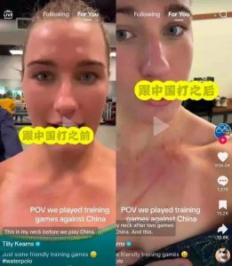 ​胸口全是血痕！中国女将晒照霸气回怼外国运动员：对抗项目，谁也别说谁