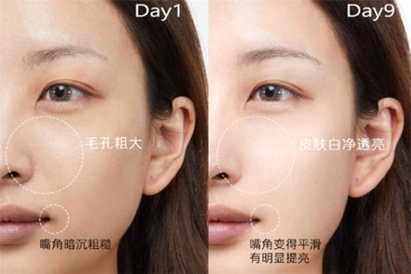 欧莱雅晶莹水怎么样 欧莱雅晶莹水是水还是精华 欧莱雅晶莹水怎么样 欧莱雅晶莹水是水还是精华